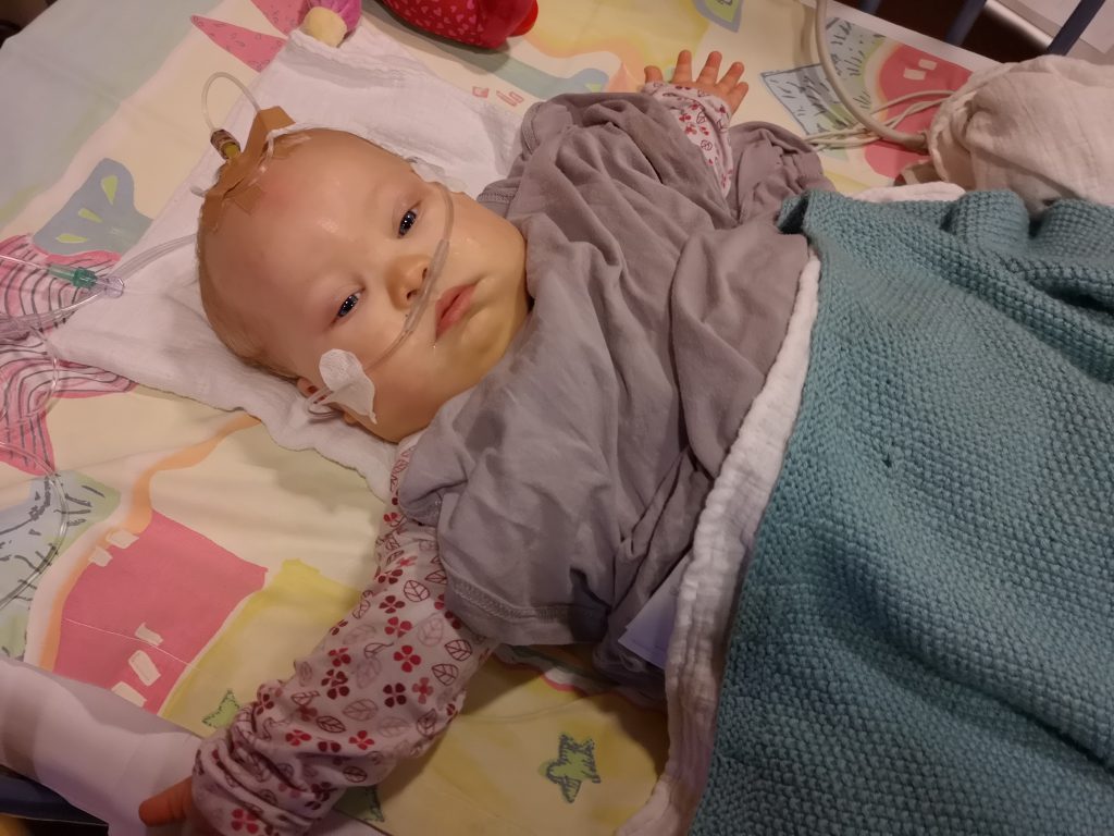Baby mit Down Syndrom im Krankenhaus